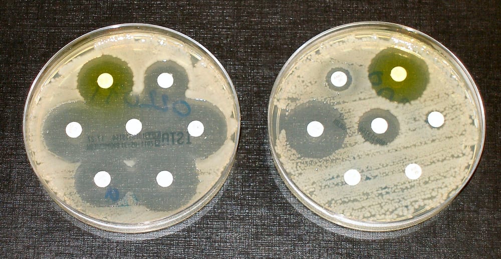 Pse ra konsumi i antibiotikëve teksa shpenzimet u rritën me 34%?