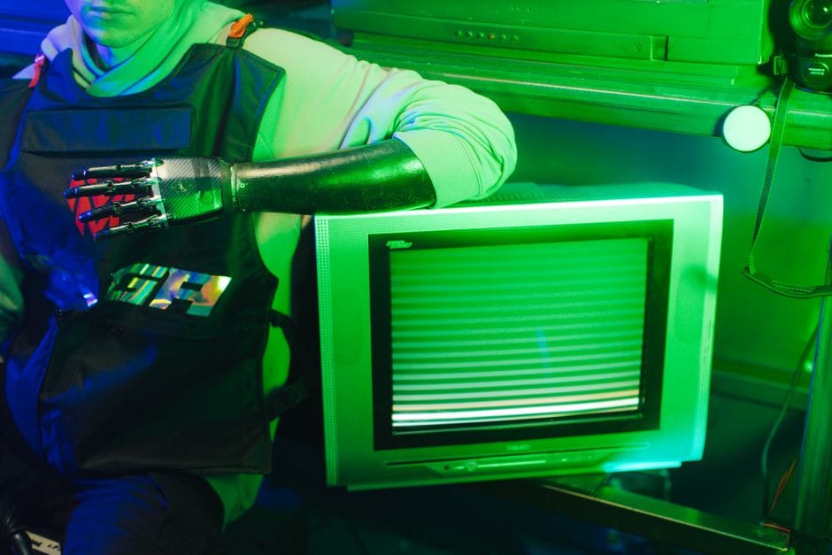 Çfarë i tha proteza elektronike ish-ushtarit të UÇK-së që ia 'fali dorën atdheut'?
