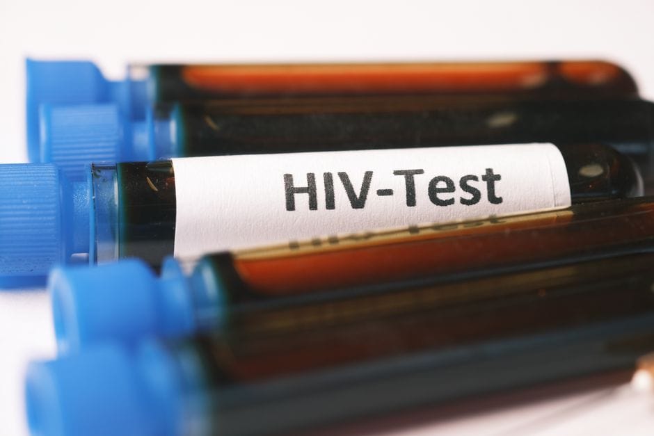 Dhjetë raste të reja me HIV dhe dy viktima në Kosovë