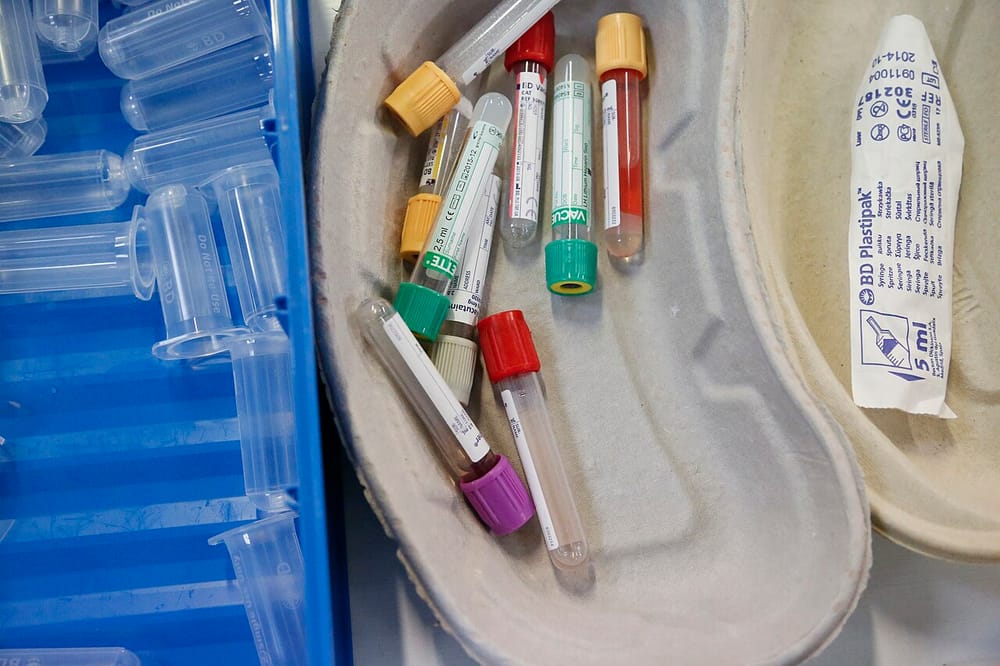 Gjoba sa 2% e xhiros për prodhuesit e testeve 'in vitro' — minimumi 700 mijë lekë