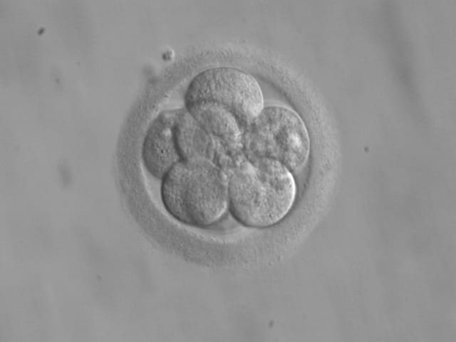 Sa konsultime IVF ka pasur Klinika e Gjinekologjisë këtë vit?