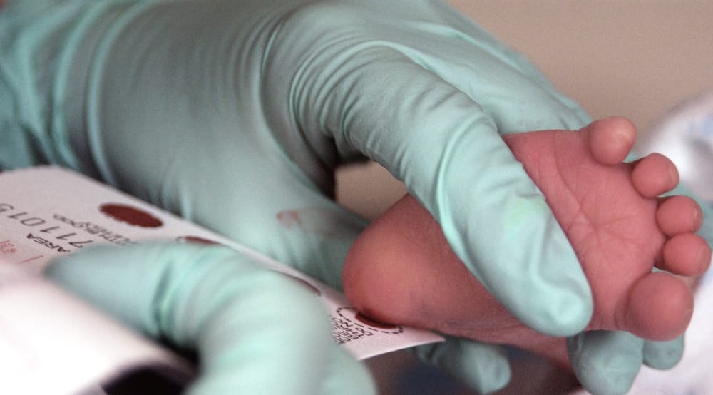 Sa foshnja kanë testuar në programin e zgjeruar të skriningut neonatal në Kosovë?