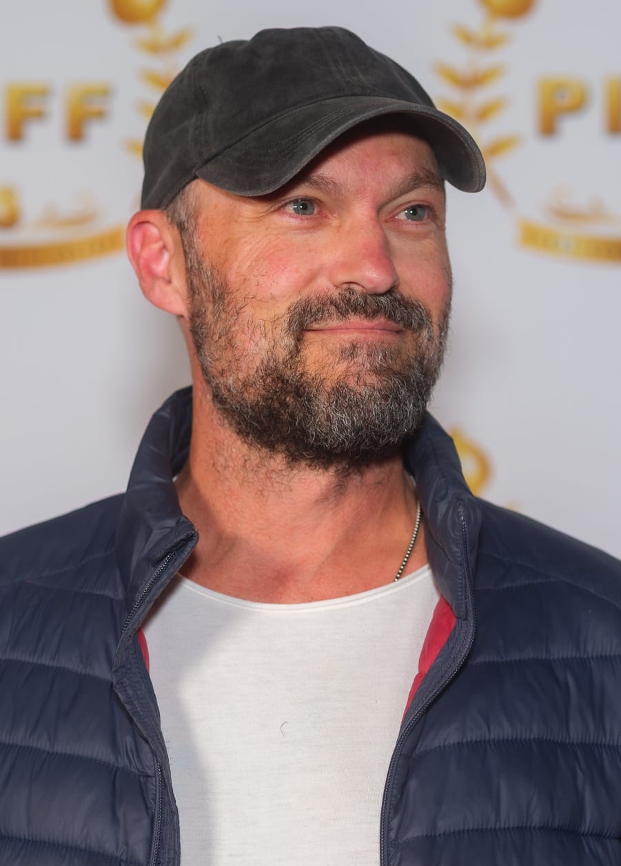 Brian Austin Green rrëfen betejën neurologjike dhe rikuperimin e gjatë