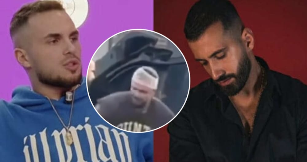 Pamjet e para të Edit me fashë në kokë pas pretendimeve për përplasje me Jozin