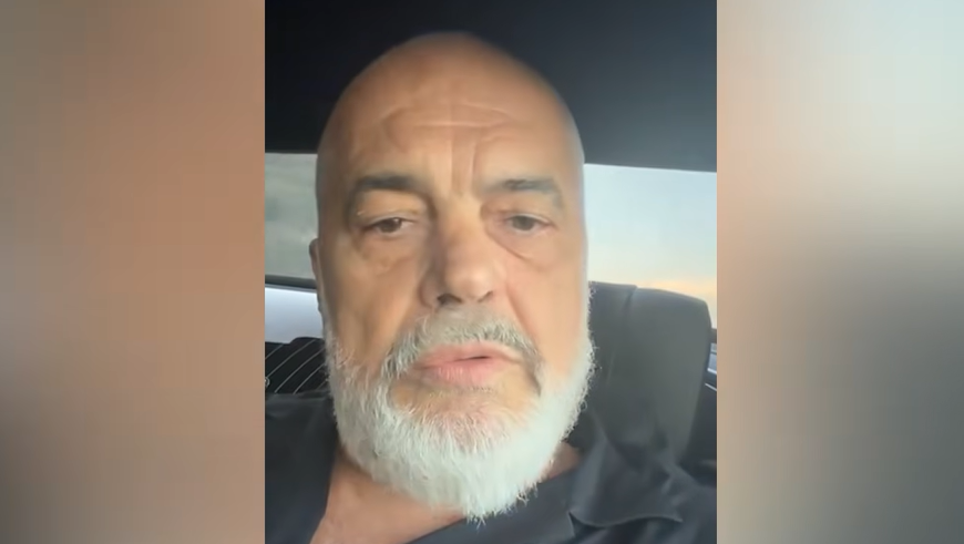 Rama shpjegon gjurmën në hundë: pasojë e dhunës të kaluarës