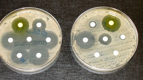 Pse ra konsumi i antibiotikëve teksa shpenzimet u rritën me 34%?