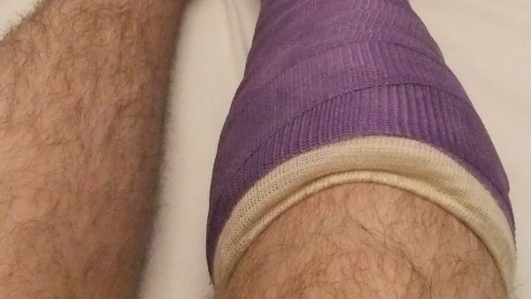 Çfarë trajtim marrin rreth 200 foshnja me anomali të lindura çdo vit në Tiranë?