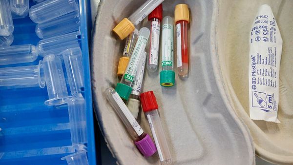 Gjoba sa 2% e xhiros për prodhuesit e testeve 'in vitro' — minimumi 700 mijë lekë