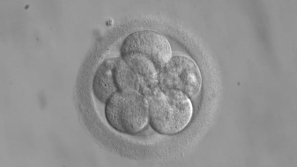 Sa konsultime IVF ka pasur Klinika e Gjinekologjisë këtë vit?