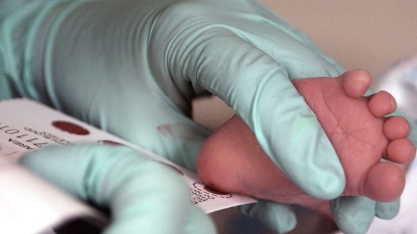 Sa foshnja kanë testuar në programin e zgjeruar të skriningut neonatal në Kosovë?