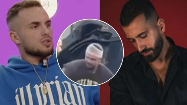 Pamjet e para të Edit me fashë në kokë pas pretendimeve për përplasje me Jozin