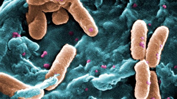 Numri i kontrolleve u ul në Gostivar, uji i papastër me Pseudomonas aeruginosa