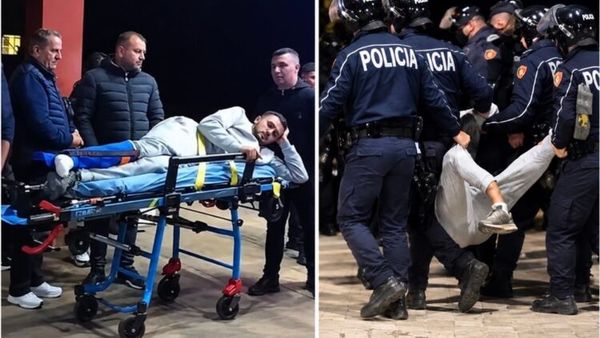 Iu thye këmba në protestë, 19-vjeçari i nënshtrohet operacionit