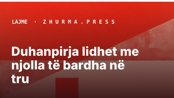 Duhanpirja lidhet me njolla të bardha në tru