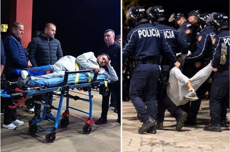 Iu thye këmba në protestë, 19-vjeçari i nënshtrohet operacionit